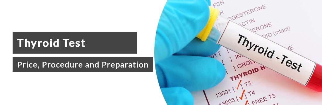 Thyroid Test: Price, Procedure and Preparation